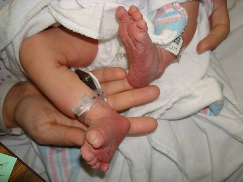 Sawyer's feet / 10 fingers, 10 toes